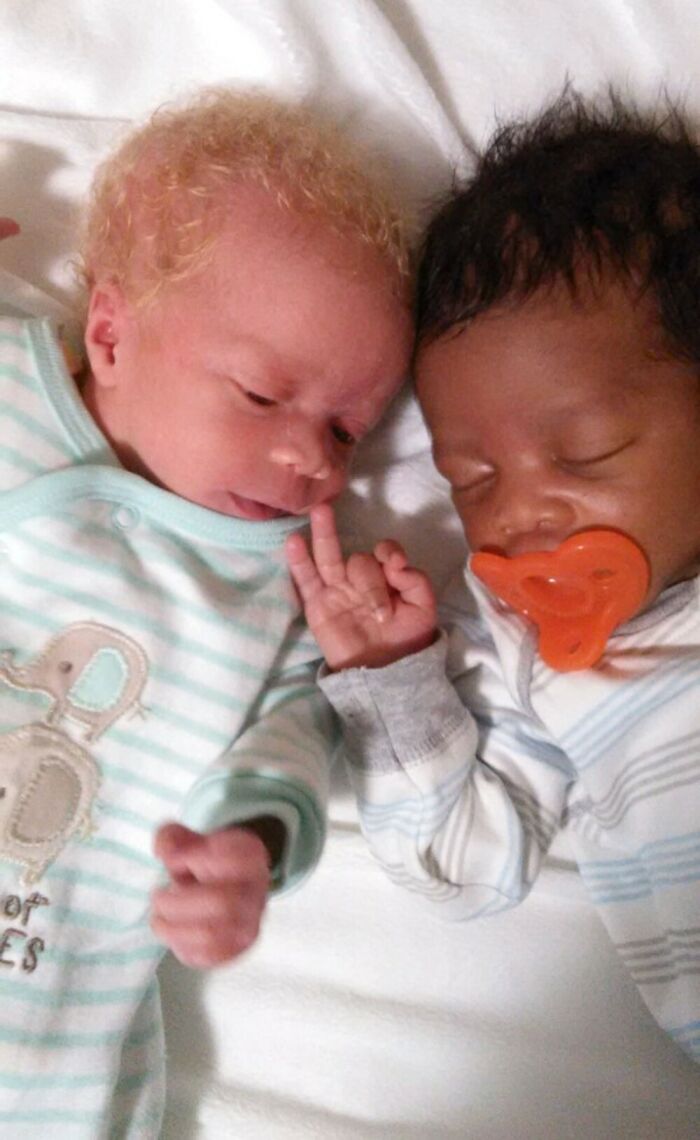 Woman Gave Birth To Black And White Twins, Thought She Was Handed The Wrong Baby