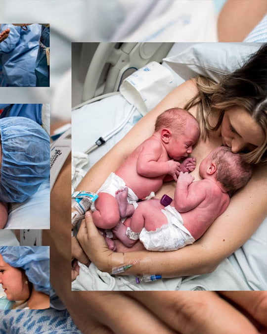 Stunning Photos Capture The Special Moments Of Twins’ Birth