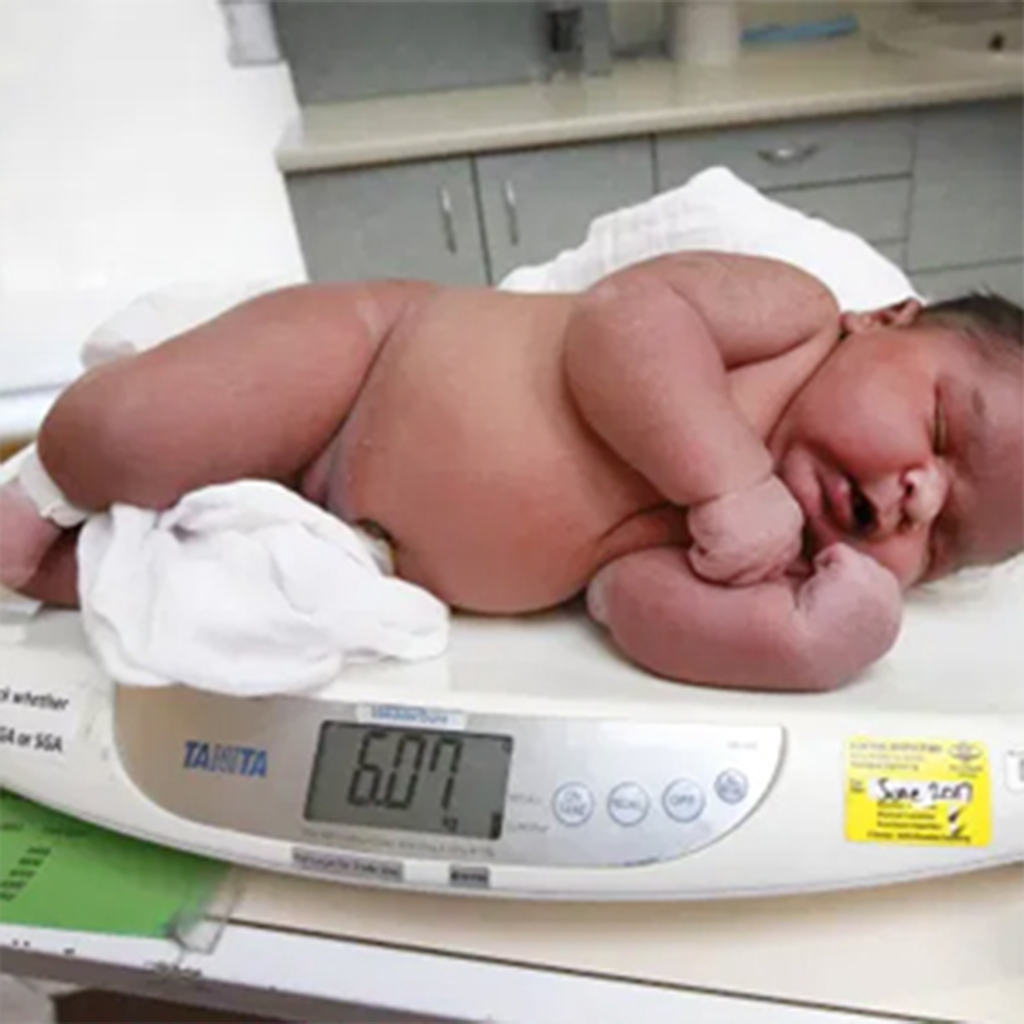 The baby born in India has a world record weight of 13kg, making viewers mistaken for photoshop